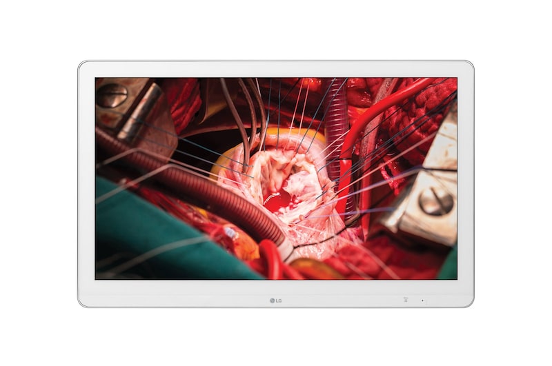 MONITOR MEDICO LG 27'